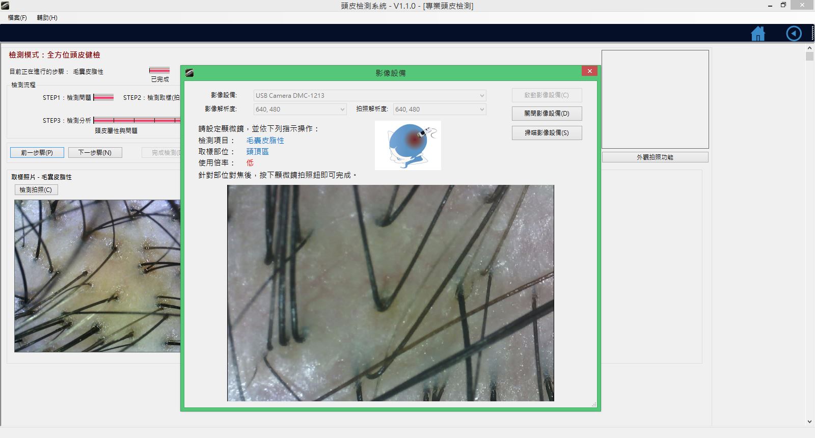 頭皮檢測取樣分析