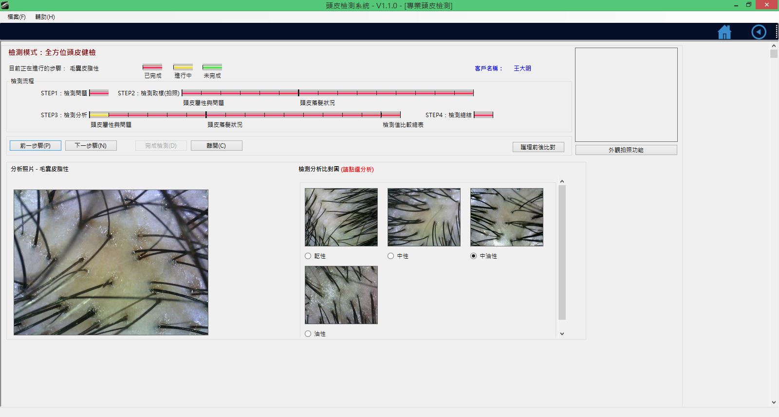 頭皮檢測取樣分析